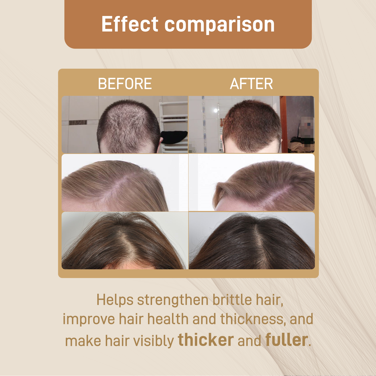 Googeer Dense Hair Dietary Supplement Drops Nourishes Roots, Prevents Breakouts And Strengthens Hair Care Supplements